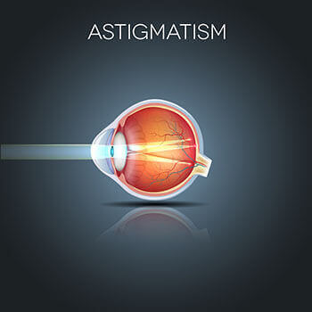 How Astigmatism Affects an Eye