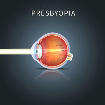 How Presbyopia Affects an Eye